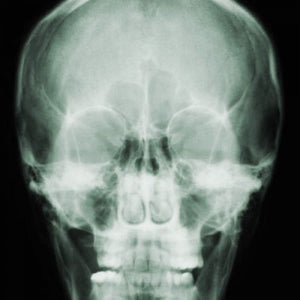 picture of a skull facing forwards