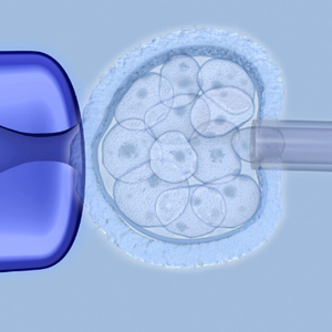ivf procedure