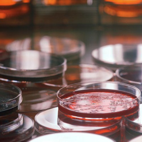 petri dishes