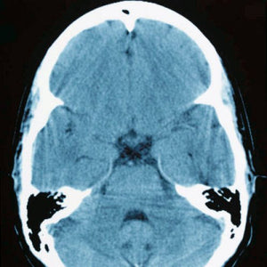 scan of brain