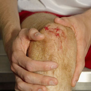 grazed knee